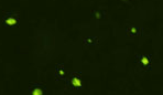 green micelles